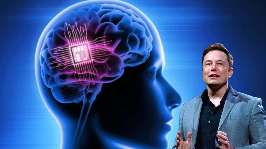 Neuralink